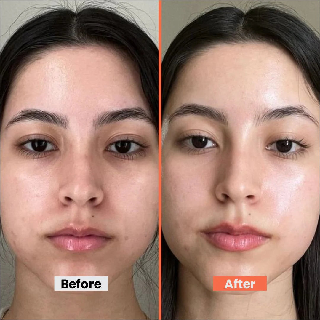 Ultra-Hydrating Sunscreen SPF 50